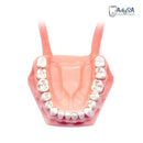 Tipodonto Adulto con Preparaciones