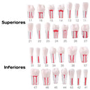 Dientes Endodoncia Pulpa 28pz Nis DT