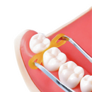 Cuñas Elásticas 60 pz DT