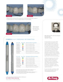 Espátulas Dietschi 5pz Hu-Friedy