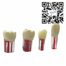 Dientes Endodoncia c/4 pz. DT