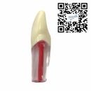 Dientes Endodoncia c/5 pz. DT