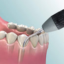 Inserto ultrasonico Mango giratorio