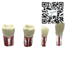 Dientes Endodoncia c/5 pz. DT