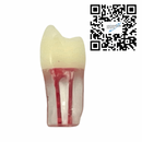 Dientes Endodoncia c/5 pz. DT