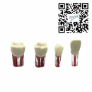 Dientes Endodoncia c/5 pz. DT